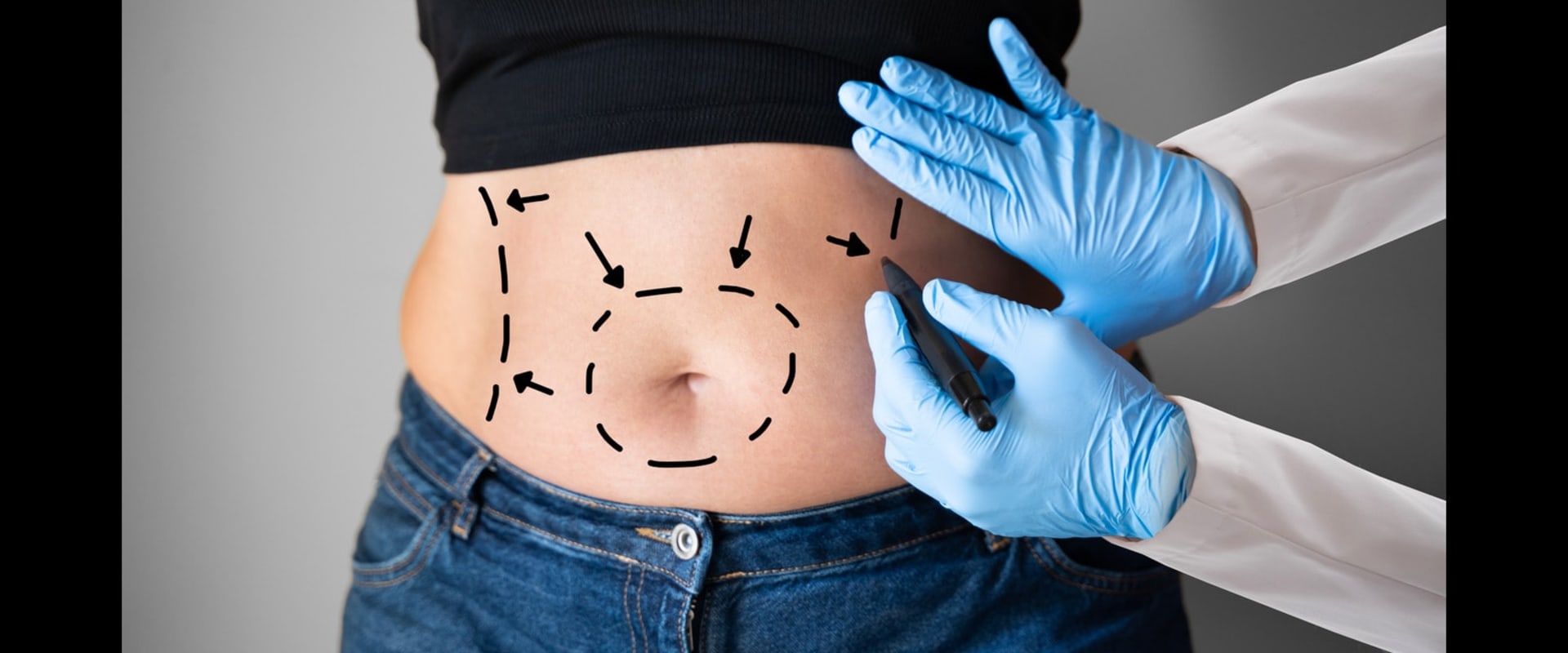 The Risks of Non-Surgical Fat Reduction
