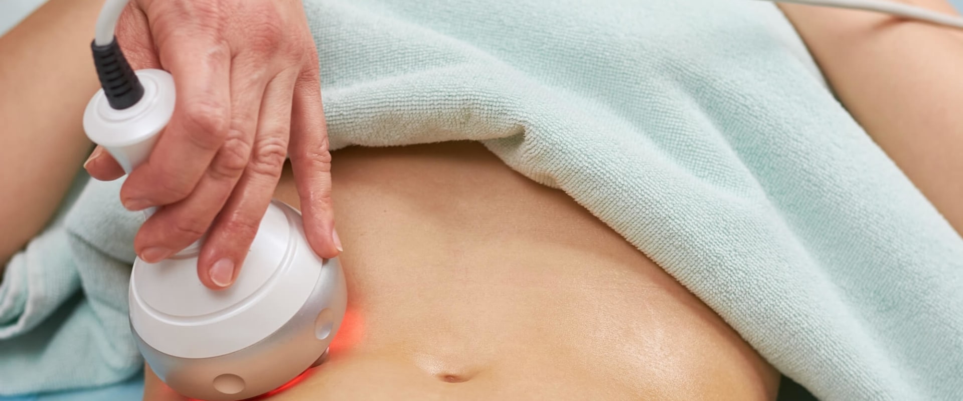 3 Benefits of Non-Surgical Fat Reduction