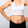 Can I Have a Non-Surgical Fat Reduction Treatment While Pregnant or Breastfeeding?