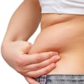 How Long Does Fat Freezing Treatment Last?