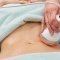 Does Non-Surgical Fat Removal Really Work?
