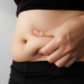 How to Achieve Fat Reduction with Non-Surgical Treatments