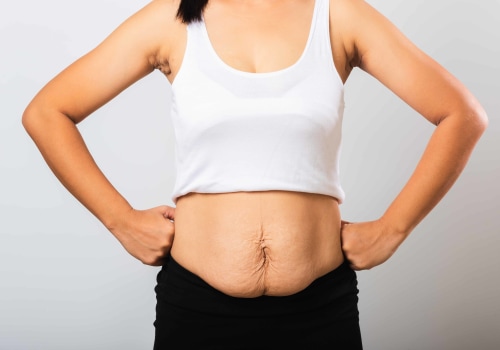 Can I Have a Non-Surgical Fat Reduction Treatment While Pregnant or Breastfeeding?