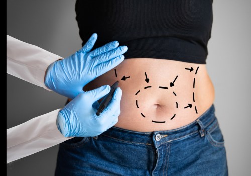 The Risks of Non-Surgical Fat Reduction