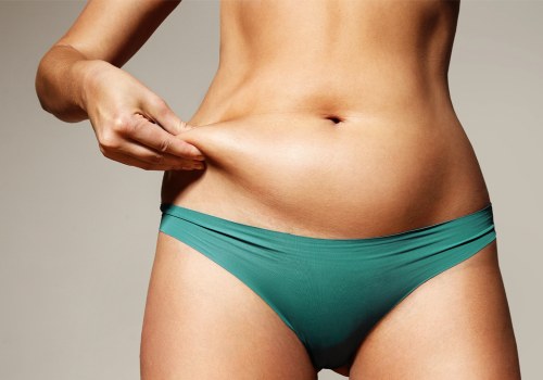 The Smart Start: How A Medical Weight Loss Clinic Prepares You For Better Nonsurgical Fat Reduction Outcomes In Clearwater